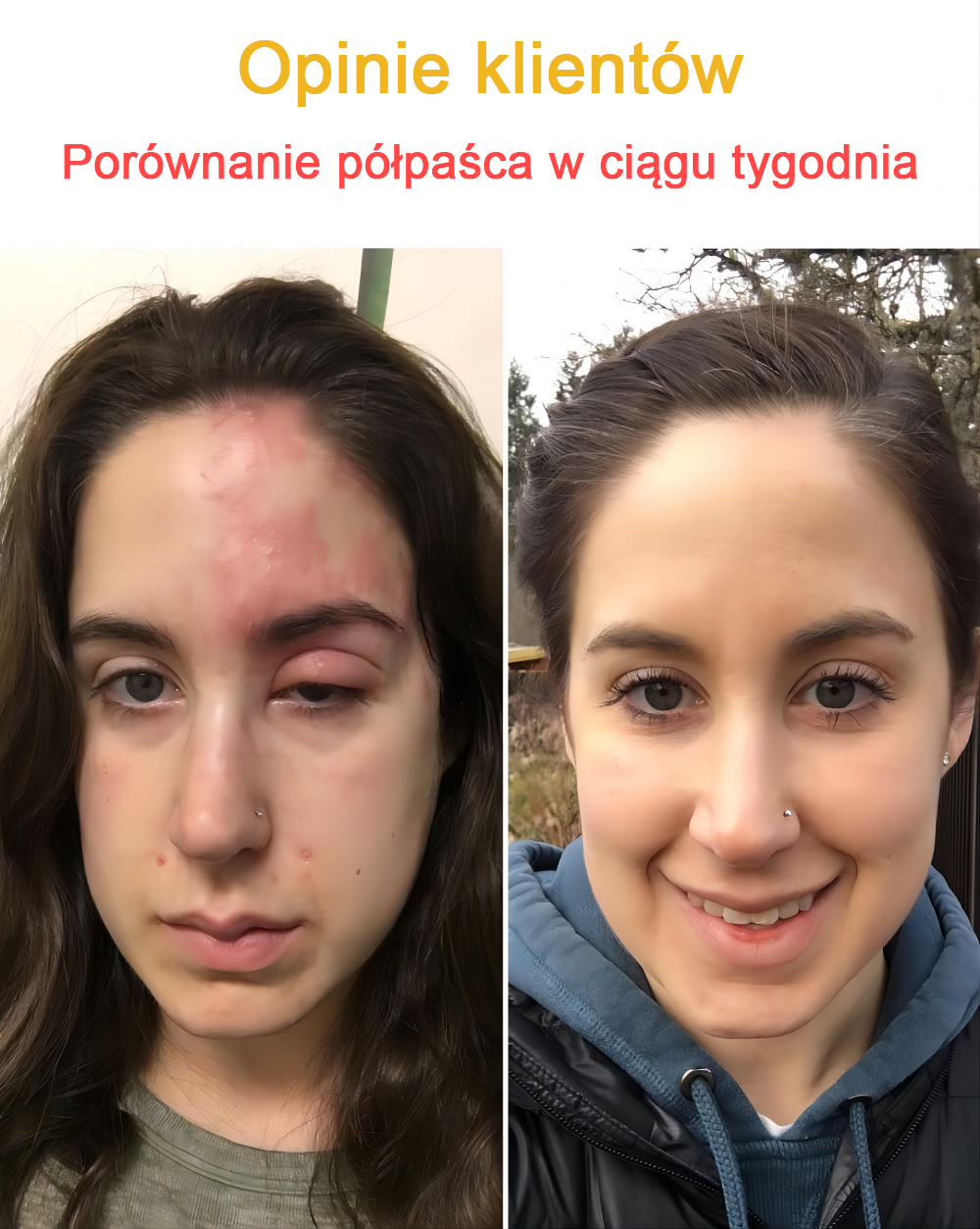 🐝✨𝑩𝑺𝑾𝑬𝑳𝑳® Krem z jadami pszczół 👨⚕️ (Rekomendacja dermatologów) (🔥Ostatni dzień promocji, 80% zniżki)