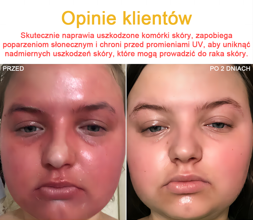 🐝✨𝑩𝑺𝑾𝑬𝑳𝑳® Krem z jadami pszczół 👨⚕️ (Rekomendacja dermatologów) (🔥Ostatni dzień promocji, 80% zniżki)