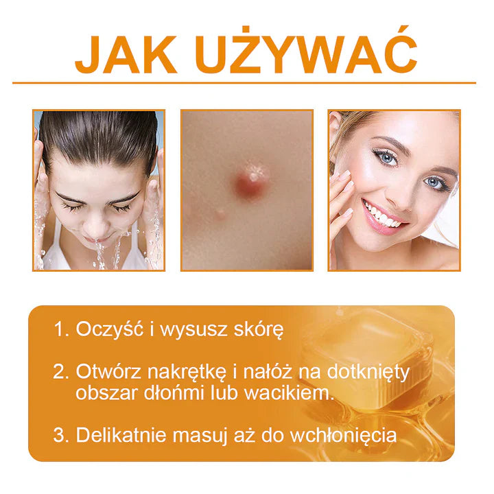 【✨Za pobraniem✨】Vsoxa™ Krem do usuwania brodawek i pieprzyków z jadem pszczelim (👨⚕Zalecenia AAD) 🐝🐝 (🔥Ostatni dzień wyprzedaży 70% taniej)