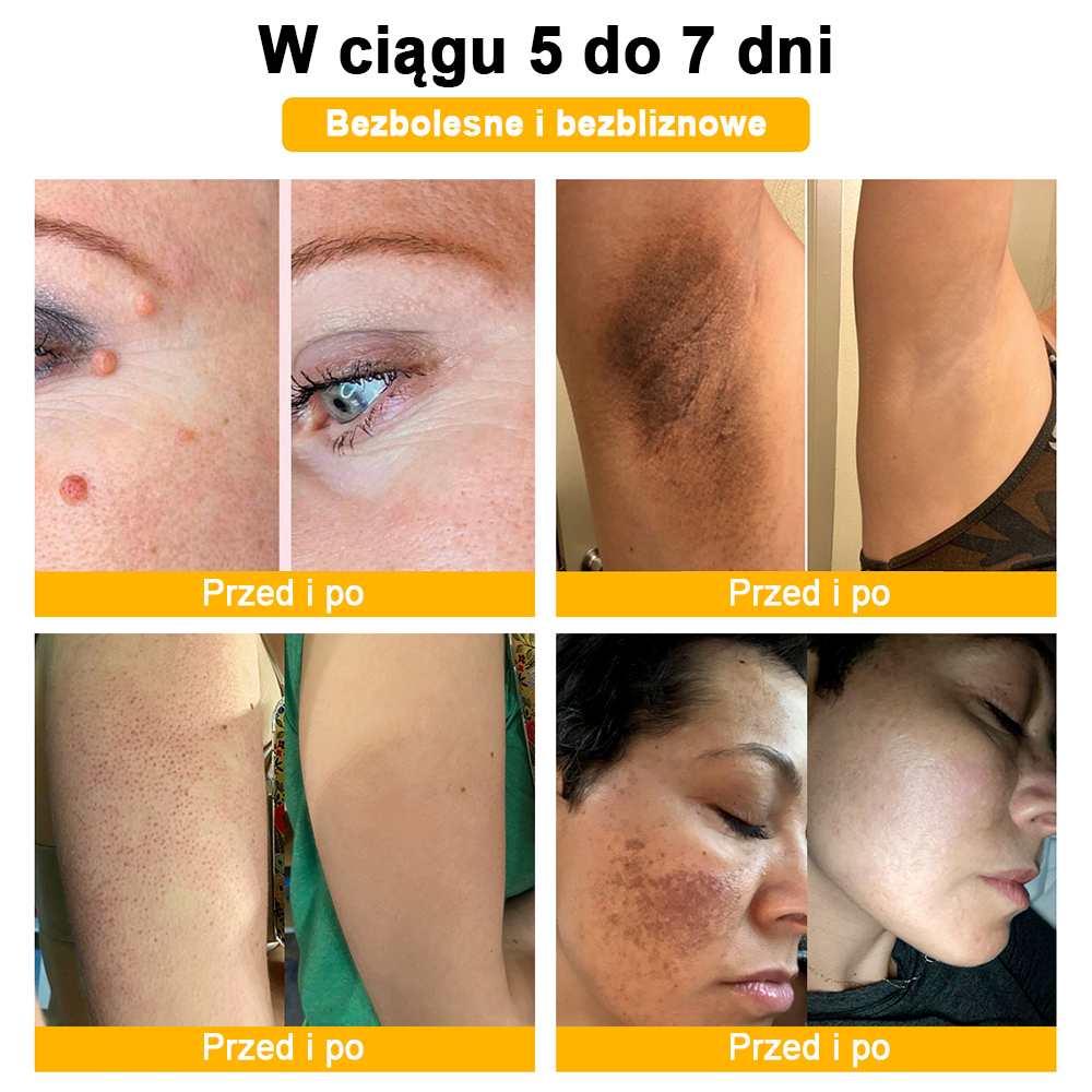 🐝✨𝑩𝑺𝑾𝑬𝑳𝑳® Krem z jadami pszczół 👨⚕️ (Rekomendacja dermatologów) (🔥Ostatni dzień promocji, 80% zniżki)
