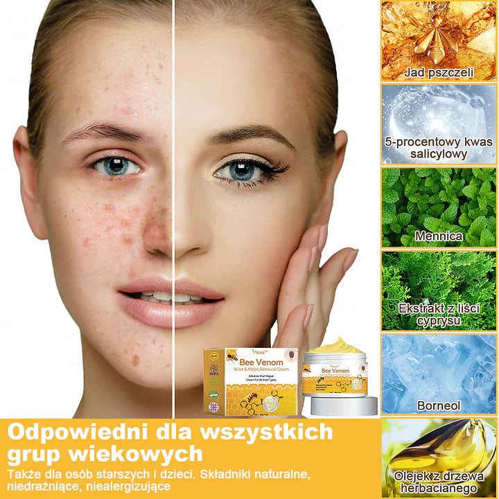 【✨Za pobraniem✨】Vsoxa™ Krem do usuwania brodawek i pieprzyków z jadem pszczelim (👨⚕Zalecenia AAD) 🐝🐝 (🔥Ostatni dzień wyprzedaży 70% taniej)
