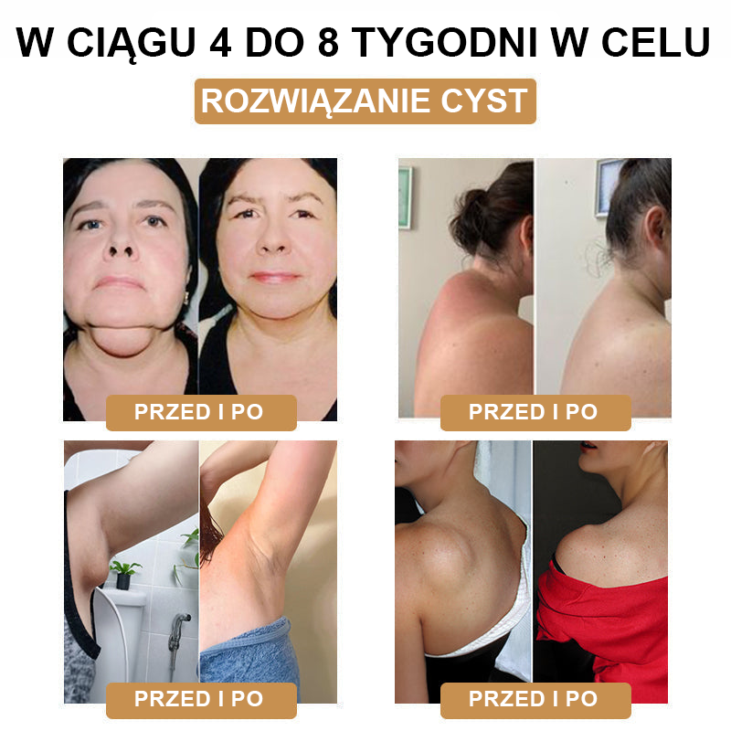 【🫧Płatność przy odbiorze🫧】Nowa bransoletka detoksykująca do liposukcji ultradźwiękowej SlimPulse™ 2024 (zalecana przez lekarza👨⚕)