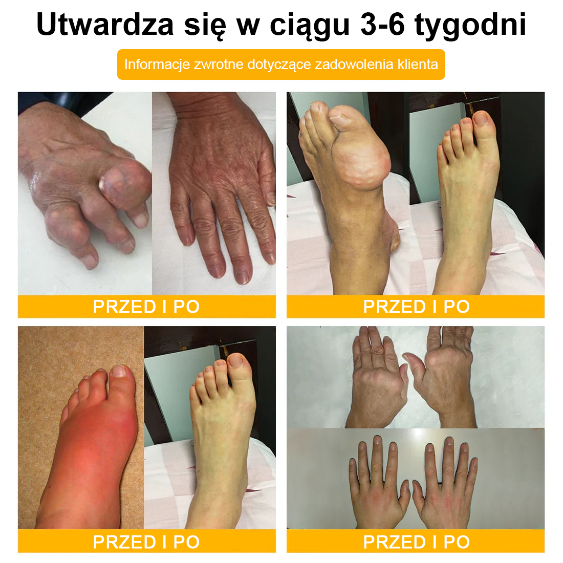 ArthroFree™ 𝑲𝒓𝒆𝒎 𝑳𝒆𝒄𝒛𝒏𝒊𝒄𝒛𝒚 𝒏𝒂 𝑩𝒐́𝒍 𝒊 𝑼𝒛𝒅𝒓𝒐𝒘𝒊𝒆𝒏𝒊𝒆 𝑲𝒐𝒔́𝒄𝒊 𝒛 𝑱𝒂𝒅𝒆𝒎 𝑷𝒔𝒛𝒄𝒛𝒆𝒍𝒊𝒎 (𝑺𝒑𝒆𝒄𝒋𝒂𝒍𝒏𝒊𝒆 𝒅𝒍𝒂 𝒐𝒔𝒐́𝒃 𝒔𝒕𝒂𝒓𝒔𝒛𝒚𝒄𝒉, 𝒛𝒂𝒍𝒆𝒄𝒂𝒏𝒚 𝒑𝒓𝒛𝒆𝒛 𝑨𝑨𝑶𝑺)