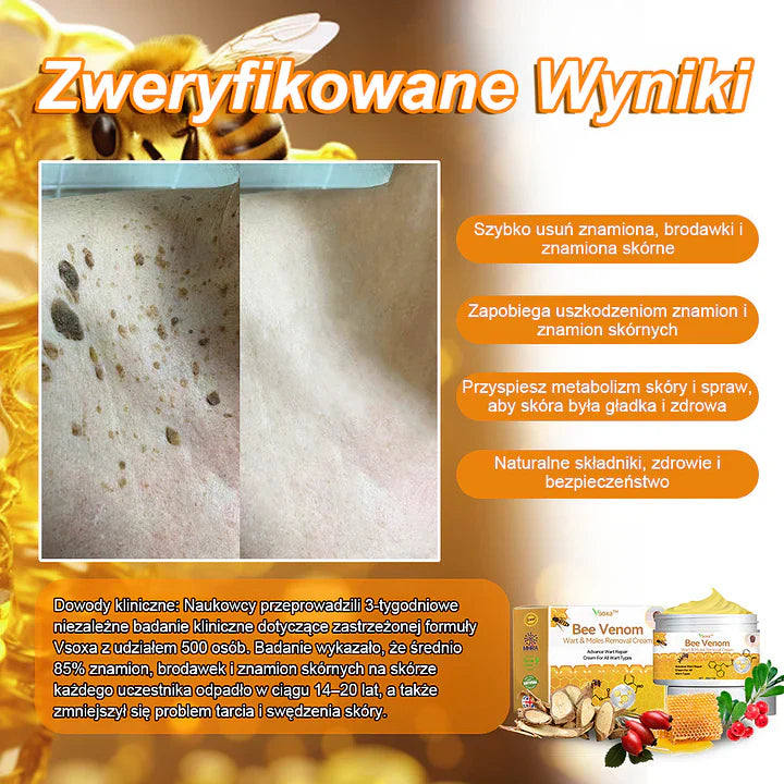 【✨Za pobraniem✨】Vsoxa™ Krem do usuwania brodawek i pieprzyków z jadem pszczelim (👨⚕Zalecenia AAD) 🐝🐝 (🔥Ostatni dzień wyprzedaży 70% taniej)