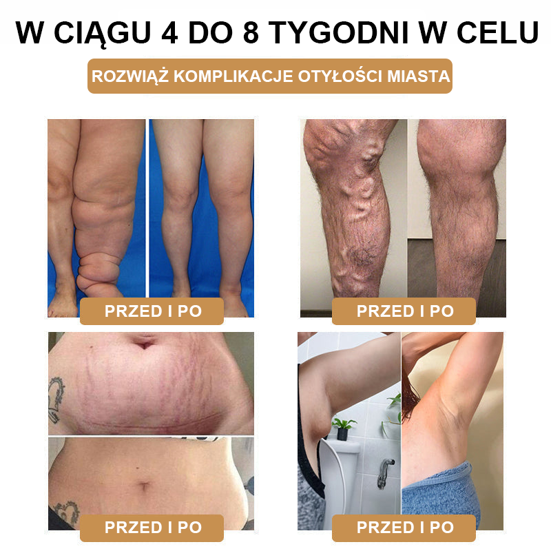 【🫧Płatność przy odbiorze🫧】Nowa bransoletka detoksykująca do liposukcji ultradźwiękowej SlimPulse™ 2024 (zalecana przez lekarza👨⚕)