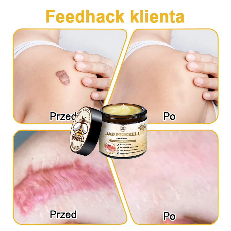 🐝✨𝑩𝑺𝑾𝑬𝑳𝑳® Krem z jadami pszczół 👨⚕️ (Rekomendacja dermatologów) (🔥Ostatni dzień promocji, 80% zniżki)