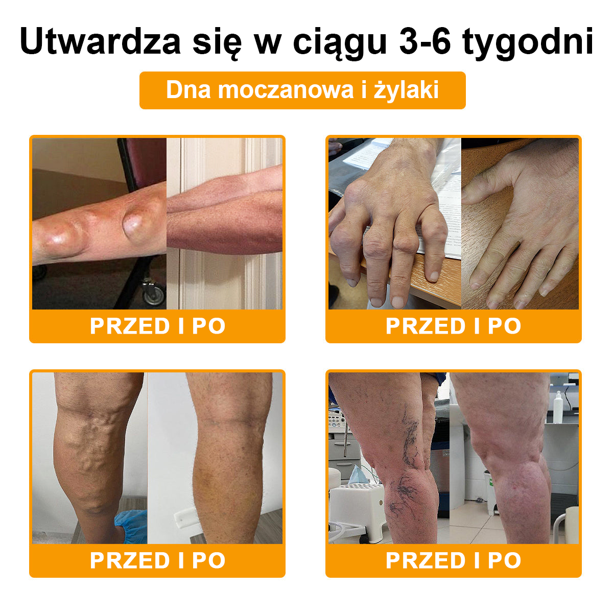 ArthroFree™ 𝑲𝒓𝒆𝒎 𝑳𝒆𝒄𝒛𝒏𝒊𝒄𝒛𝒚 𝒏𝒂 𝑩𝒐́𝒍 𝒊 𝑼𝒛𝒅𝒓𝒐𝒘𝒊𝒆𝒏𝒊𝒆 𝑲𝒐𝒔́𝒄𝒊 𝒛 𝑱𝒂𝒅𝒆𝒎 𝑷𝒔𝒛𝒄𝒛𝒆𝒍𝒊𝒎 (𝑺𝒑𝒆𝒄𝒋𝒂𝒍𝒏𝒊𝒆 𝒅𝒍𝒂 𝒐𝒔𝒐́𝒃 𝒔𝒕𝒂𝒓𝒔𝒛𝒚𝒄𝒉, 𝒛𝒂𝒍𝒆𝒄𝒂𝒏𝒚 𝒑𝒓𝒛𝒆𝒛 𝑨𝑨𝑶𝑺)