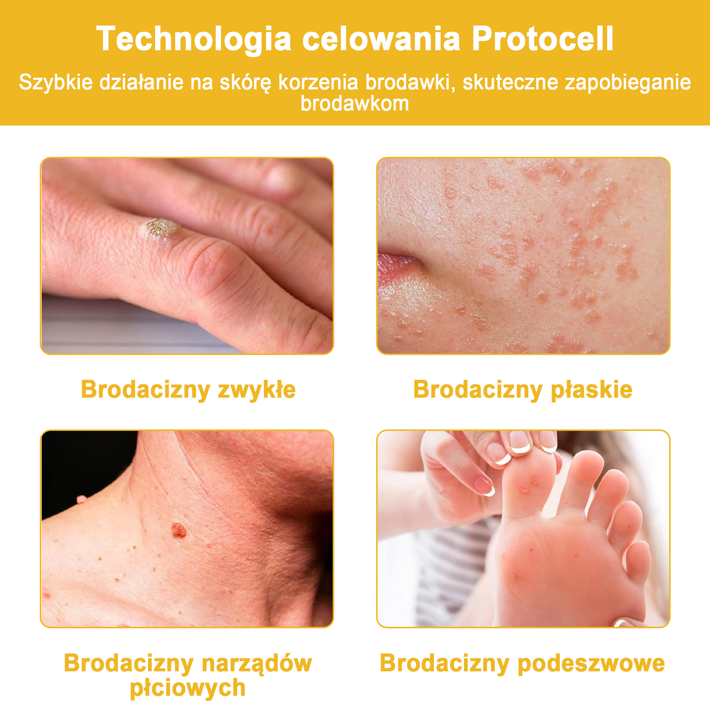 🐝✨𝑩𝑺𝑾𝑬𝑳𝑳® Krem z jadami pszczół 👨⚕️ (Rekomendacja dermatologów) (🔥Ostatni dzień promocji, 80% zniżki)