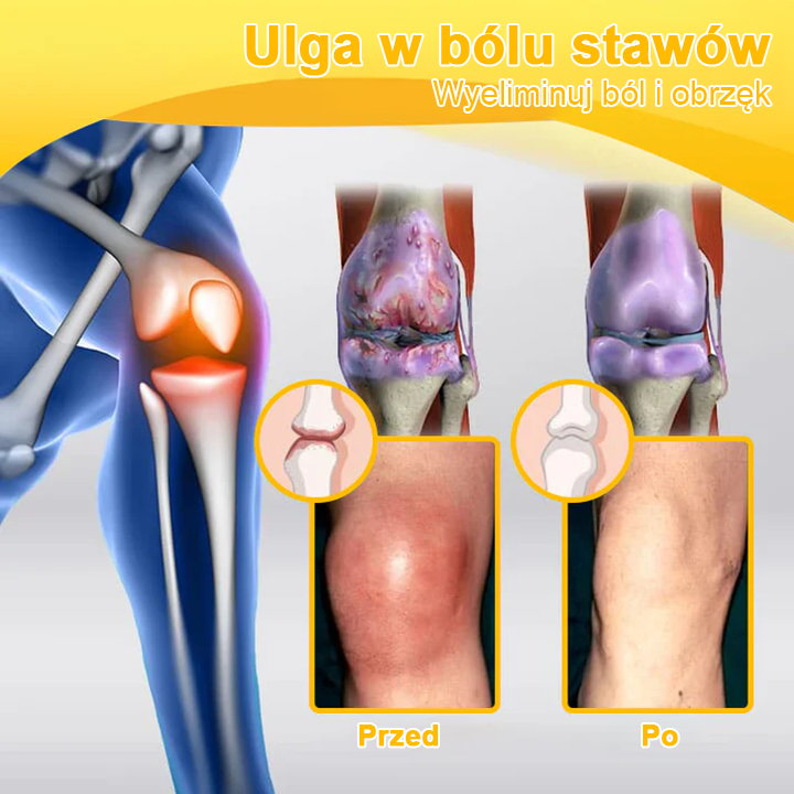 ArthroFree™ 𝑲𝒓𝒆𝒎 𝑳𝒆𝒄𝒛𝒏𝒊𝒄𝒛𝒚 𝒏𝒂 𝑩𝒐́𝒍 𝒊 𝑼𝒛𝒅𝒓𝒐𝒘𝒊𝒆𝒏𝒊𝒆 𝑲𝒐𝒔́𝒄𝒊 𝒛 𝑱𝒂𝒅𝒆𝒎 𝑷𝒔𝒛𝒄𝒛𝒆𝒍𝒊𝒎 (𝑺𝒑𝒆𝒄𝒋𝒂𝒍𝒏𝒊𝒆 𝒅𝒍𝒂 𝒐𝒔𝒐́𝒃 𝒔𝒕𝒂𝒓𝒔𝒛𝒚𝒄𝒉, 𝒛𝒂𝒍𝒆𝒄𝒂𝒏𝒚 𝒑𝒓𝒛𝒆𝒛 𝑨𝑨𝑶𝑺)