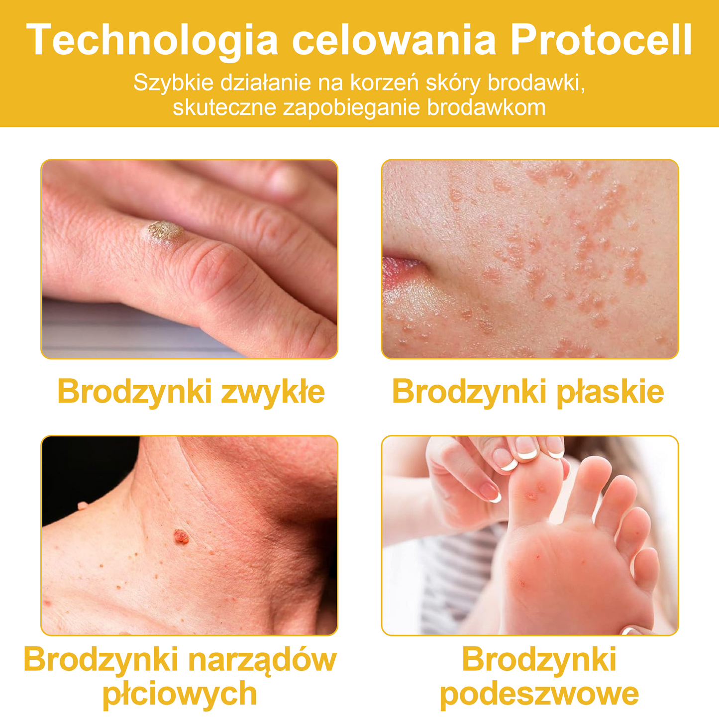 【🫧Płatność przy odbiorze🫧】Turonu™ leczniczy krem do skóry z jadem pszczelim (zalecany przez AAD)