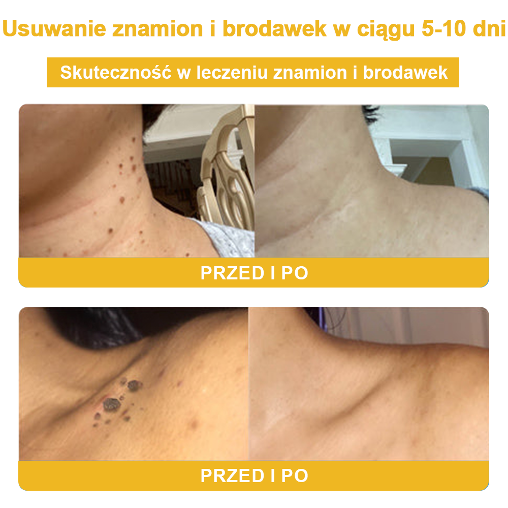 【🫧Płatność przy odbiorze🫧】Turonu™ leczniczy krem do skóry z jadem pszczelim (zalecany przez AAD)