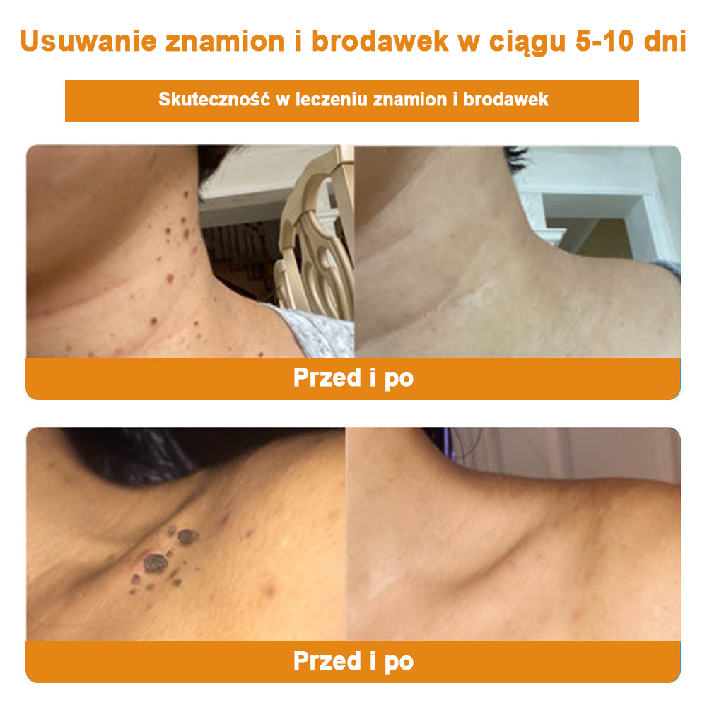 🐝✨𝑩𝑺𝑾𝑬𝑳𝑳® Krem z jadami pszczół 👨⚕️ (Rekomendacja dermatologów) (🔥Ostatni dzień promocji, 80% zniżki)