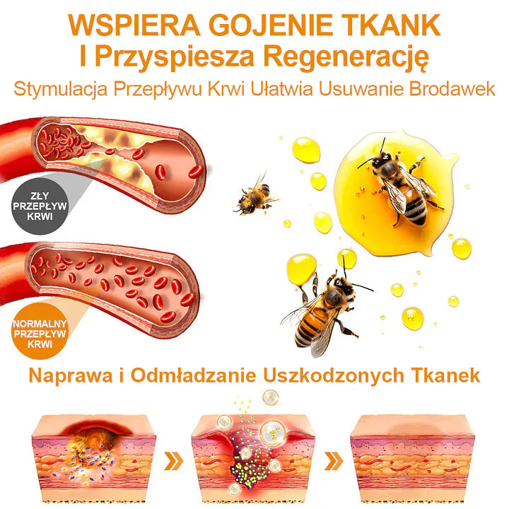 【✨Za pobraniem✨】Vsoxa™ Krem do usuwania brodawek i pieprzyków z jadem pszczelim (👨⚕Zalecenia AAD) 🐝🐝 (🔥Ostatni dzień wyprzedaży 70% taniej)