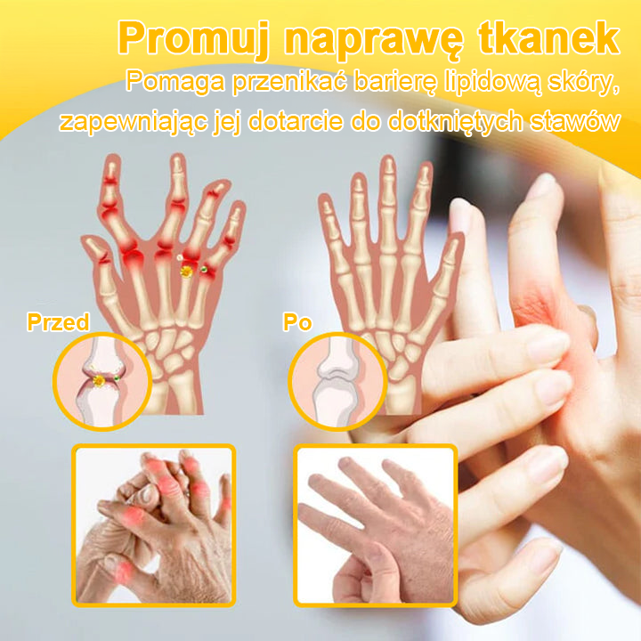 ArthroFree™ 𝑲𝒓𝒆𝒎 𝑳𝒆𝒄𝒛𝒏𝒊𝒄𝒛𝒚 𝒏𝒂 𝑩𝒐́𝒍 𝒊 𝑼𝒛𝒅𝒓𝒐𝒘𝒊𝒆𝒏𝒊𝒆 𝑲𝒐𝒔́𝒄𝒊 𝒛 𝑱𝒂𝒅𝒆𝒎 𝑷𝒔𝒛𝒄𝒛𝒆𝒍𝒊𝒎 (𝑺𝒑𝒆𝒄𝒋𝒂𝒍𝒏𝒊𝒆 𝒅𝒍𝒂 𝒐𝒔𝒐́𝒃 𝒔𝒕𝒂𝒓𝒔𝒛𝒚𝒄𝒉, 𝒛𝒂𝒍𝒆𝒄𝒂𝒏𝒚 𝒑𝒓𝒛𝒆𝒛 𝑨𝑨𝑶𝑺)
