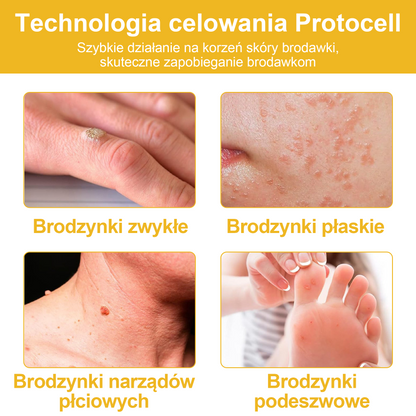【🫧Płatność przy odbiorze🫧】Turonu™ leczniczy krem do skóry z jadem pszczelim (zalecany przez AAD)