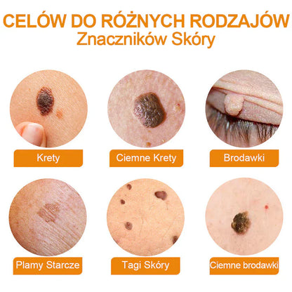 【✨Za pobraniem✨】Vsoxa™ Krem do usuwania brodawek i pieprzyków z jadem pszczelim (👨‍⚕Zalecenia AAD) 🐝🐝 (🔥Ostatni dzień wyprzedaży 70% taniej)